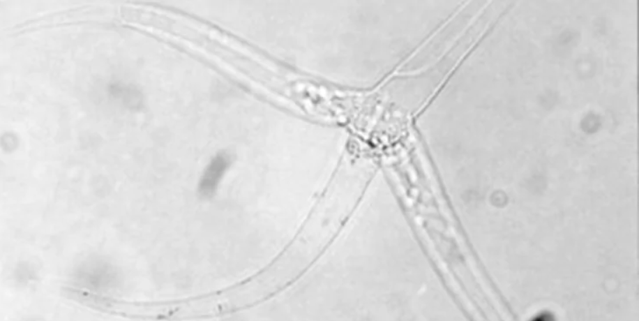 Смотрите, как выглядит самое маленькое животное в мире (фото)